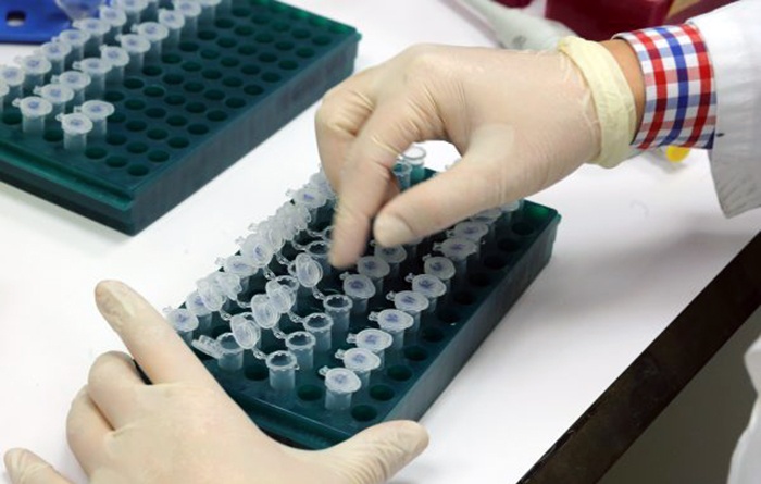 Enfermedades raras lab