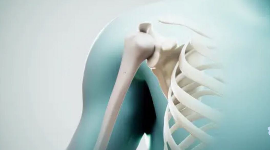 Expertos prevén que la osteoporosis se duplique en América Latina para 2050 